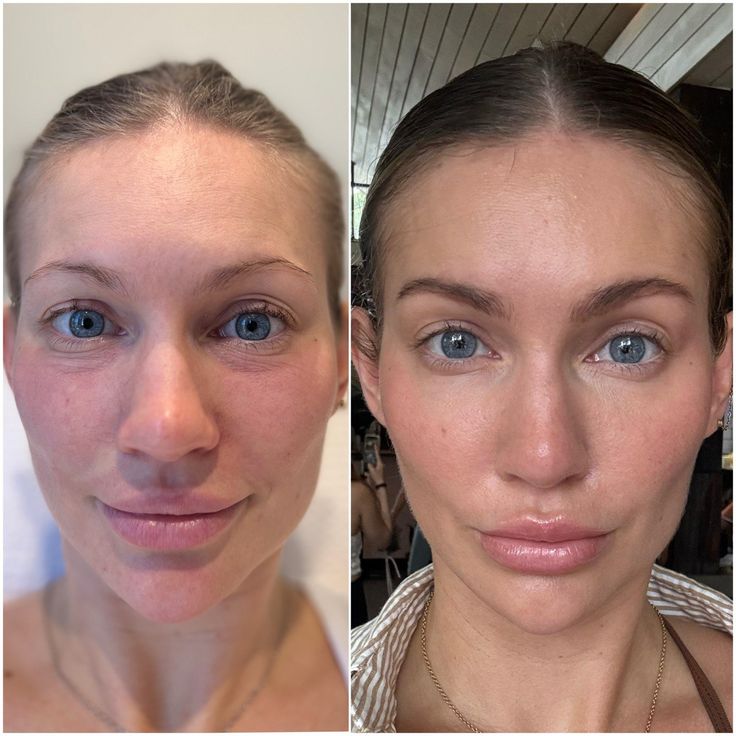 <p><br/>“Beyond the Jawline: What eleve Gua Sha Can Really Do”<br/><br/></p>