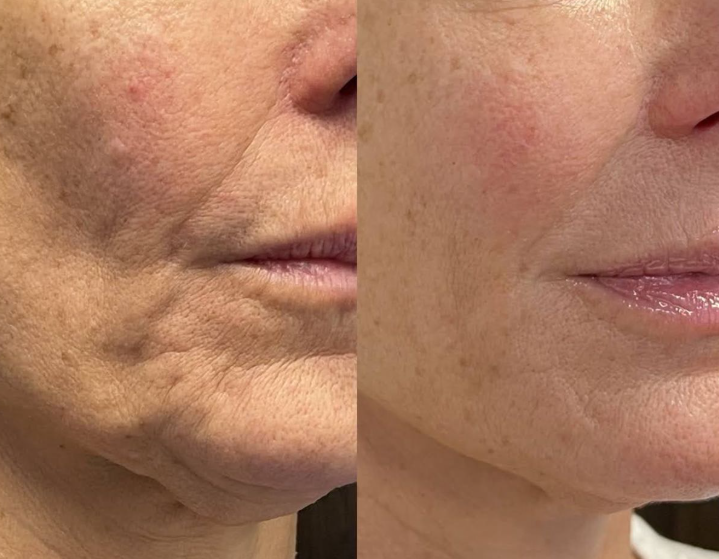 <p><br/>“Beyond the Jawline: What eleve Gua Sha Can Really Do”<br/><br/></p>