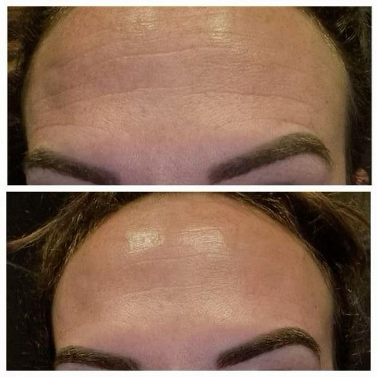 <p><br/>“Beyond the Jawline: What eleve Gua Sha Can Really Do”<br/><br/></p>